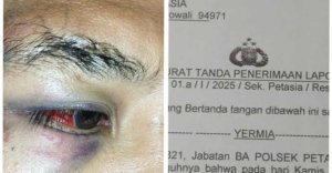 Mabuk Miras Tiga Pemuda Keroyok Seorang Kasubag di Morut