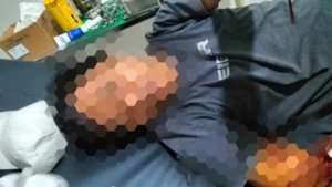 Diduga Karna Sengketa Lahan, Seorang Warga Kolonodale Dibacok