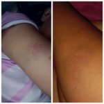 Seorang Perempuan di Peboa Alami Kekerasan, Berulang Kali di Kasari tidak Berani Lapor Polisi