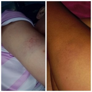 Seorang Perempuan di Peboa Alami Kekerasan, Berulang Kali di Kasari tidak Berani Lapor Polisi